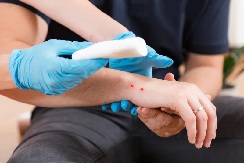 Get urgent medical care after a suspected human bite