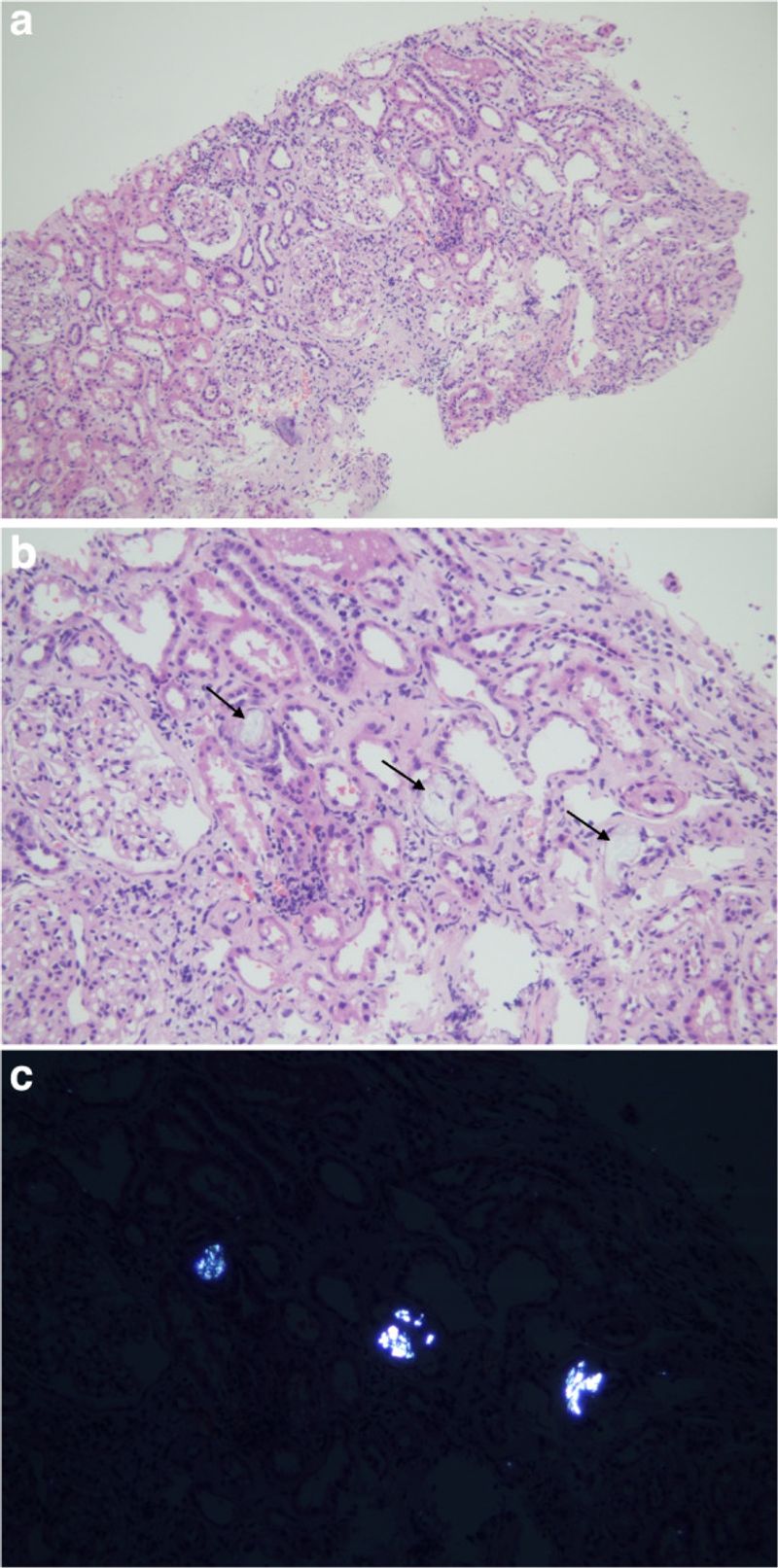 Keep the oxalate evidence in proportion