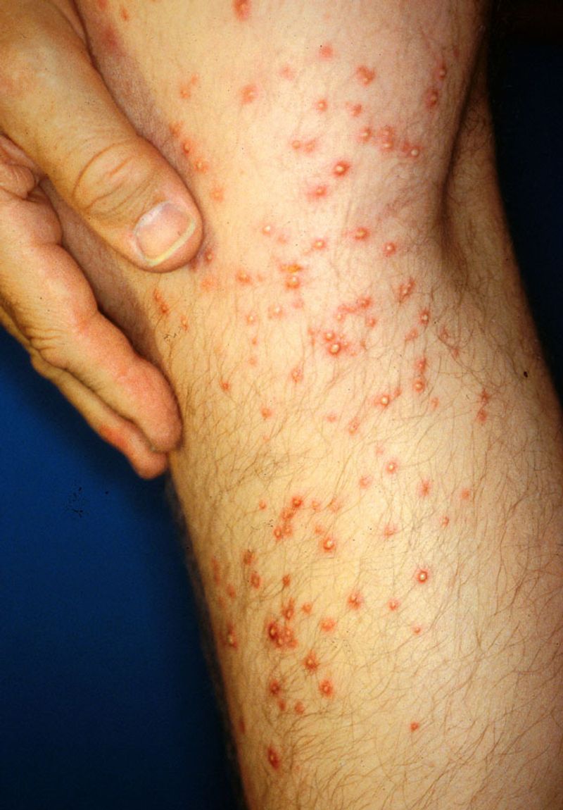 Ways to ease pain and itching