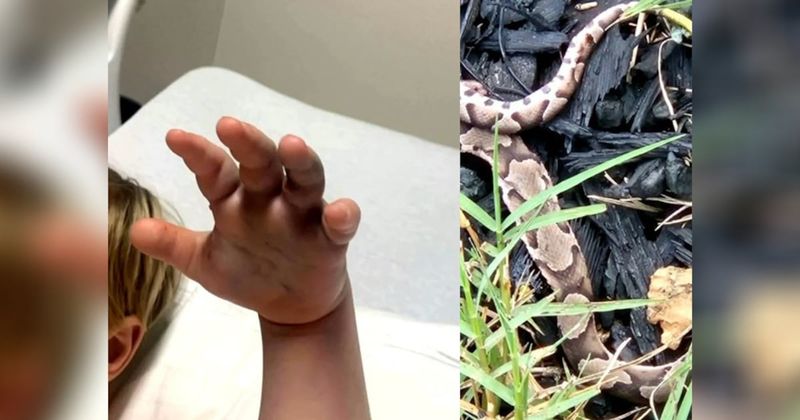 Call 911 for a suspected copperhead bite