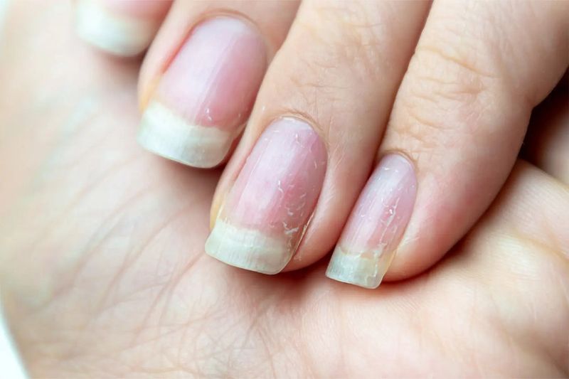 Condition Cuticles and Strengthen Nails