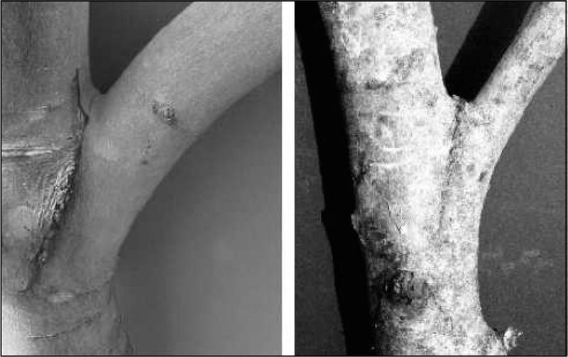 Keeping Narrow-Angled Limbs