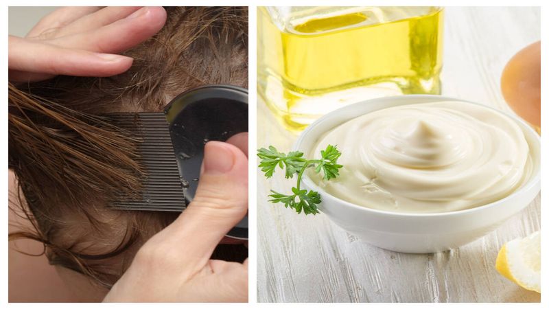 Treat Head Lice