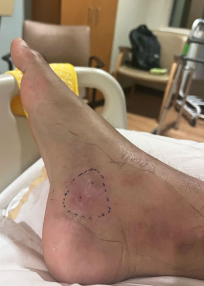 Do not judge the bite by how it looks at first
