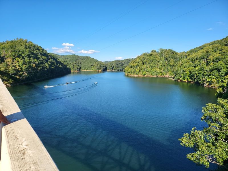 What To Expect Before You Go