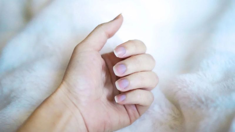 Blue Nail Beds Warn of Oxygen Problems