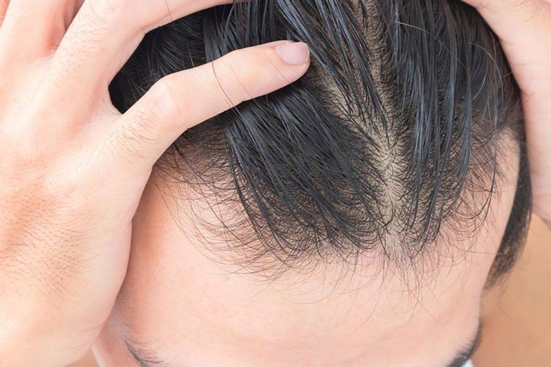 Hair Thinning or Texture Changes