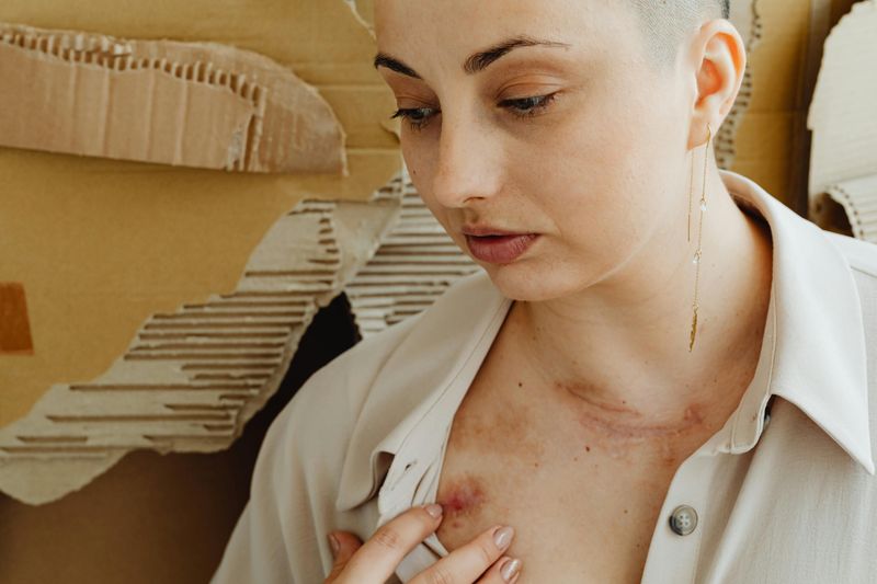 Higher Exposure to Trauma and Abuse