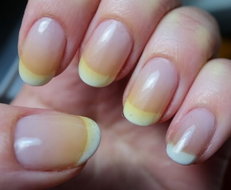 Yellow Nails May Indicate Liver Problems