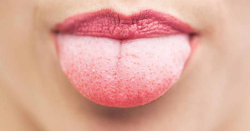 The tongue has specific taste zones.