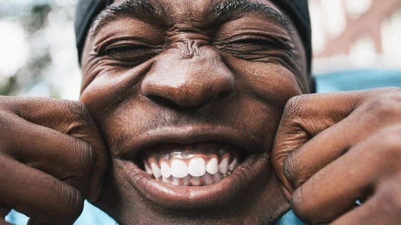 You Laugh Off Your Pain or Use Humor to Deflect
