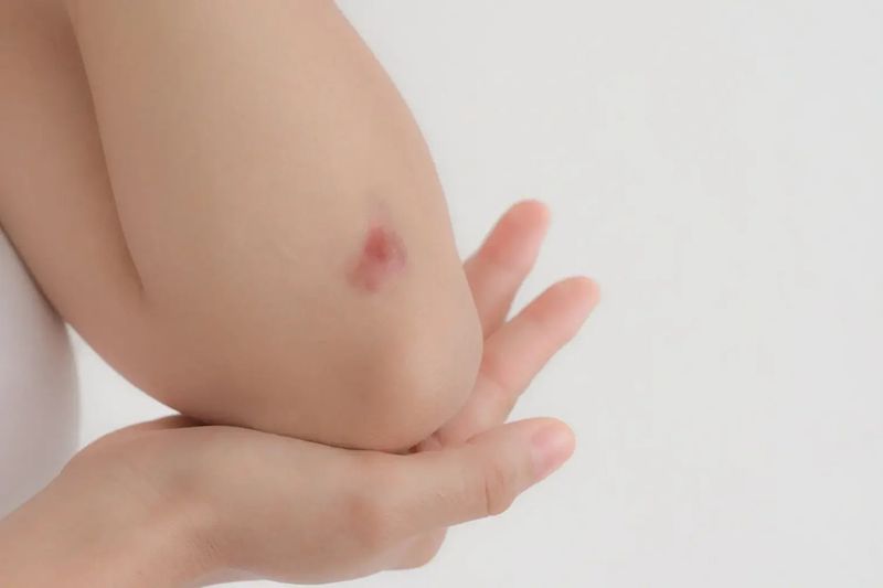 Slow-Healing Cuts and Bruises