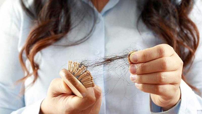 Hair Thinning and Loss