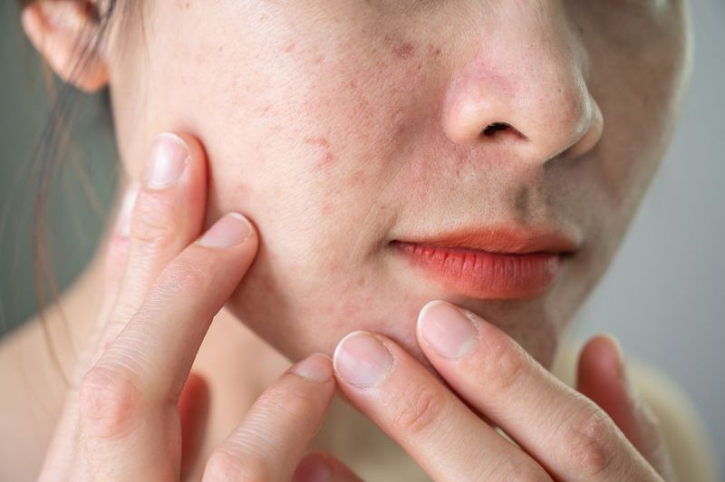 Skin Texture Transformations