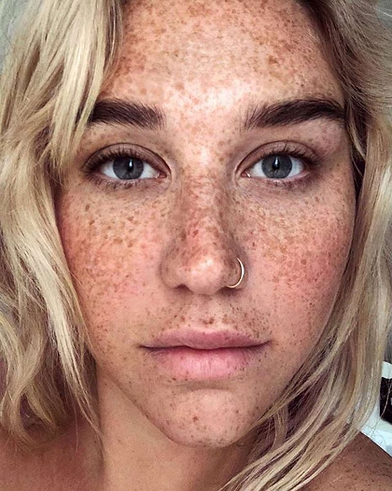 Kesha