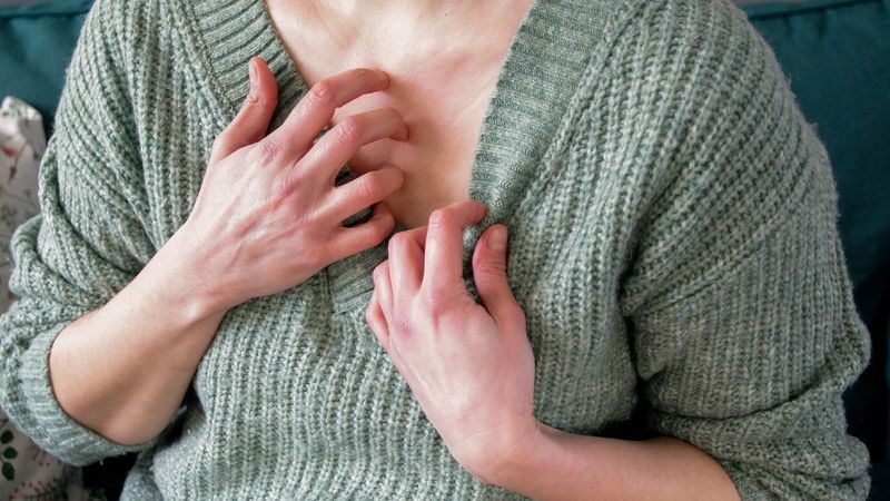 Skin Reactions and Unexplained Rashes