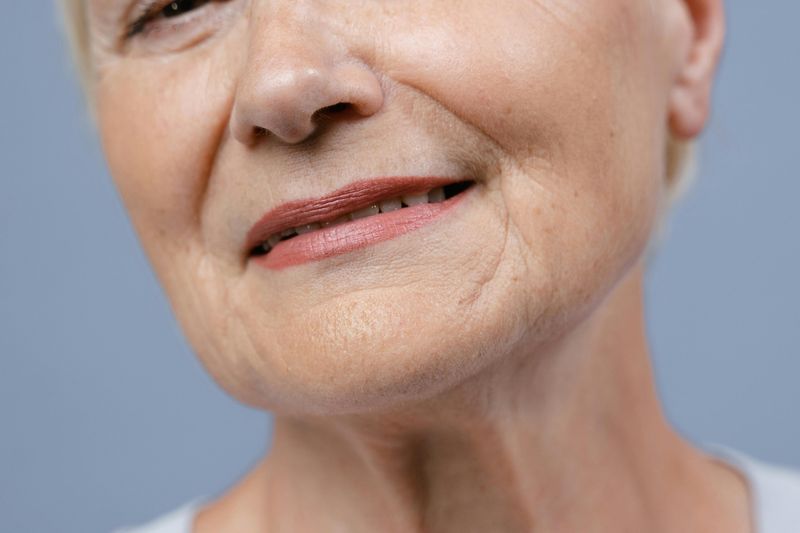 Collagen Loss Creates Fine Lines