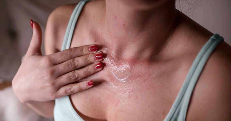 Random Skin Flare-Ups and Rashes