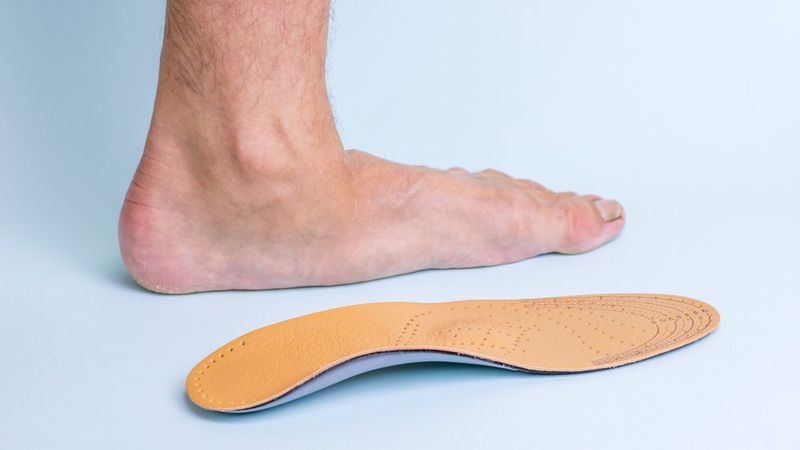 Feet Naturally Flatten Over Time